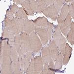 HABP4 Antibody in Immunohistochemistry (Paraffin) (IHC (P))