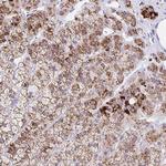ANKRD9 Polyclonal Antibody