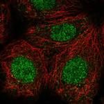 CASKIN1 Polyclonal Antibody