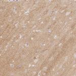 CASKIN1 Antibody in Immunohistochemistry (Paraffin) (IHC (P))