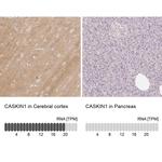 CASKIN1 Antibody in Immunohistochemistry (IHC)