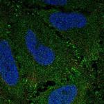 ZBED3 Polyclonal Antibody