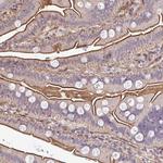 ZBED3 Antibody in Immunohistochemistry (Paraffin) (IHC (P))