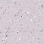KIFC1 Antibody in Immunohistochemistry (Paraffin) (IHC (P))
