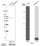KIFC1 Antibody in Western Blot (WB)