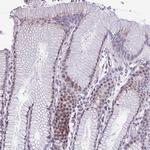 ZNF682 Polyclonal Antibody