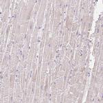COPZ2 Antibody in Immunohistochemistry (IHC)