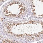 COPZ2 Antibody in Immunohistochemistry (IHC)