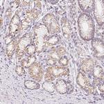 COPZ2 Antibody in Immunohistochemistry (IHC)