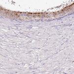 HEXB Antibody in Immunohistochemistry (IHC)