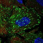 Tensin 3 Polyclonal Antibody