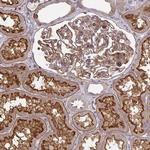 Tensin 3 Antibody in Immunohistochemistry (IHC)