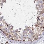 DYRK4 Antibody in Immunohistochemistry (IHC)