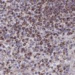 DYRK4 Antibody in Immunohistochemistry (IHC)