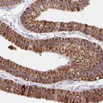 DYRK4 Antibody in Immunohistochemistry (IHC)