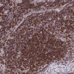ERI1 Polyclonal Antibody