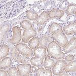 PALM3 Antibody in Immunohistochemistry (IHC)