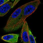 ANKRD57 Polyclonal Antibody