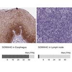 ANKRD57 Antibody in Immunohistochemistry (IHC)