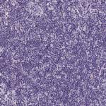 ANKRD57 Antibody in Immunohistochemistry (IHC)