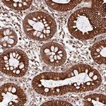 ZNF790 Polyclonal Antibody