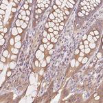 RAB1A Antibody in Immunohistochemistry (Paraffin) (IHC (P))