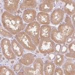 RAB1A Antibody in Immunohistochemistry (Paraffin) (IHC (P))
