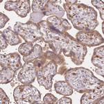 RAB1A Polyclonal Antibody