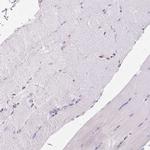 RAB1A Antibody in Immunohistochemistry (Paraffin) (IHC (P))