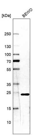 RAB1A Antibody in Western Blot (WB)