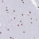 DDX52 Polyclonal Antibody