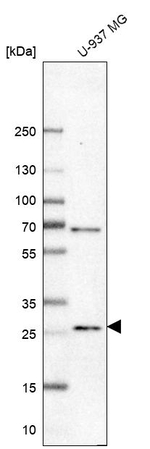 RNASE3 Antibody in Western Blot (WB)