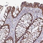 MRPL53 Antibody in Immunohistochemistry (IHC)