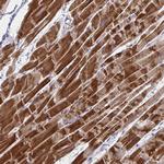 NDUFC2 Polyclonal Antibody