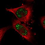 PUS7L Polyclonal Antibody