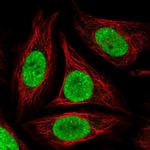 GLTSCR1 Polyclonal Antibody