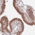 GLTSCR1 Antibody in Immunohistochemistry (Paraffin) (IHC (P))
