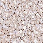 GLTSCR1 Antibody in Immunohistochemistry (Paraffin) (IHC (P))