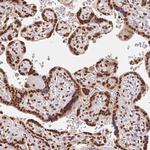 GLTSCR1 Antibody in Immunohistochemistry (Paraffin) (IHC (P))