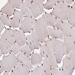 GLTSCR1 Antibody in Immunohistochemistry (Paraffin) (IHC (P))