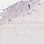 ZNF417 Antibody in Immunohistochemistry (Paraffin) (IHC (P))
