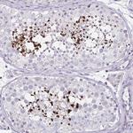 D2HGDH Polyclonal Antibody