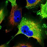 AKAP12 Polyclonal Antibody