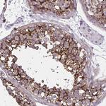 AKAP12 Antibody in Immunohistochemistry (Paraffin) (IHC (P))