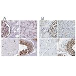 AKAP12 Antibody in Immunohistochemistry (IHC)