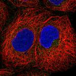 PIP5KL1 Polyclonal Antibody