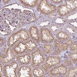 PIP5KL1 Antibody in Immunohistochemistry (Paraffin) (IHC (P))
