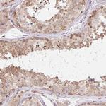 TBPL2 Polyclonal Antibody