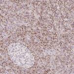 ZFP41 Polyclonal Antibody