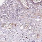 Cyclin I2 Antibody in Immunohistochemistry (Paraffin) (IHC (P))